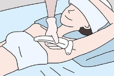 使用家用光子脫毛儀，你需要知道這幾點