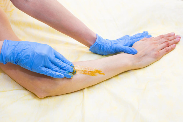 脫毛那些事之光動力脫毛(圖1)