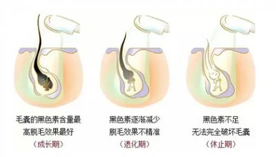 為什么小姐姐們都選擇在春季脫毛呢？