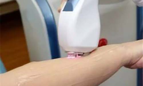 夏季脫毛：為什么有人說光子脫毛沒有效果？(圖3)