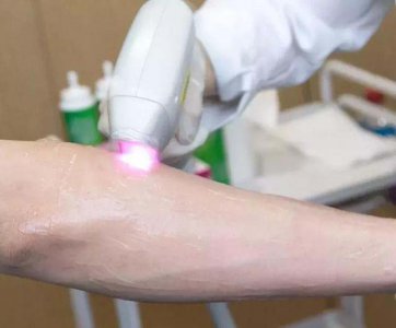 家用光子脫毛儀種草指南