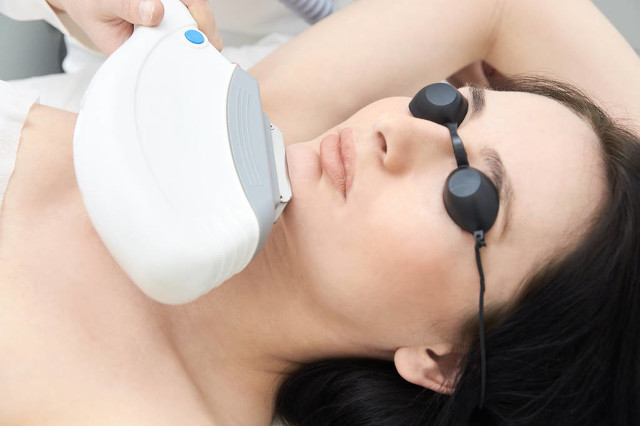 IPL、OPT、強脈沖光與光子嫩膚到底有什么區別呢？(圖1)