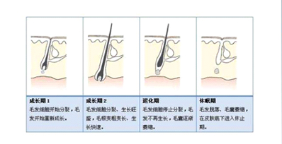 為什么有時候感覺家用脫毛儀效果不明顯？(圖1)