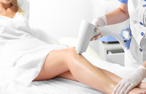 脫毛儀選購(gòu)攻略(圖1)