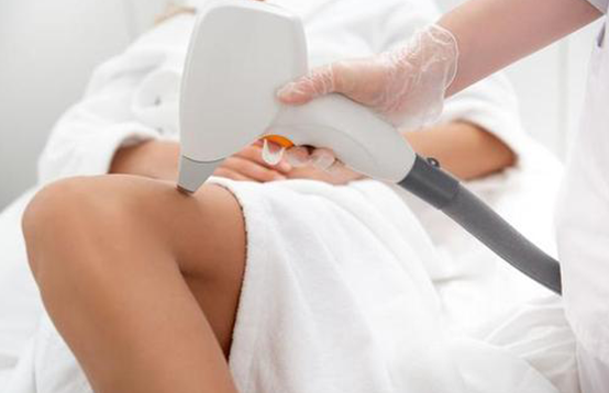 激光脫毛，女生腿毛長是一種怎樣的體驗？(圖1)