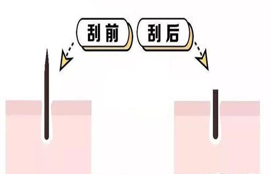 脫毛不徹底，毛毛的生命力到底有多頑強(qiáng)？(圖3)