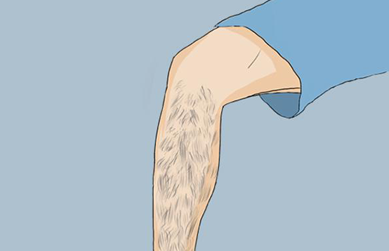 盤點那些錯誤的脫毛方法 ,你中招了沒(圖1) 盤點那些錯誤的脫毛方法 ,你中招了沒(圖1)